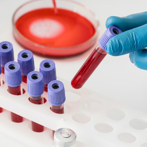 SAMOT Productos Laboratorio Análisis de Muestras